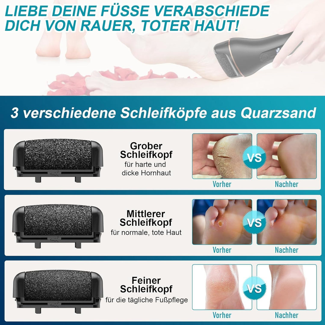 AOMEES Hornhautentferner Elektrisch, Elektrischer Hornhautentferner mit IPX7 Wasserdicht, 2 Geschwin