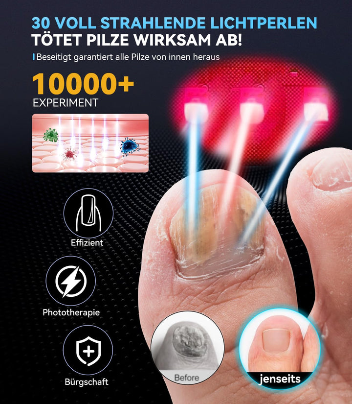 6.0 Nagelpilz Laser mit Zeitmessgerät Nagelpilz Lasergerät【3 Blau 1 Infrarot-Stärkste Wirkung】Laser