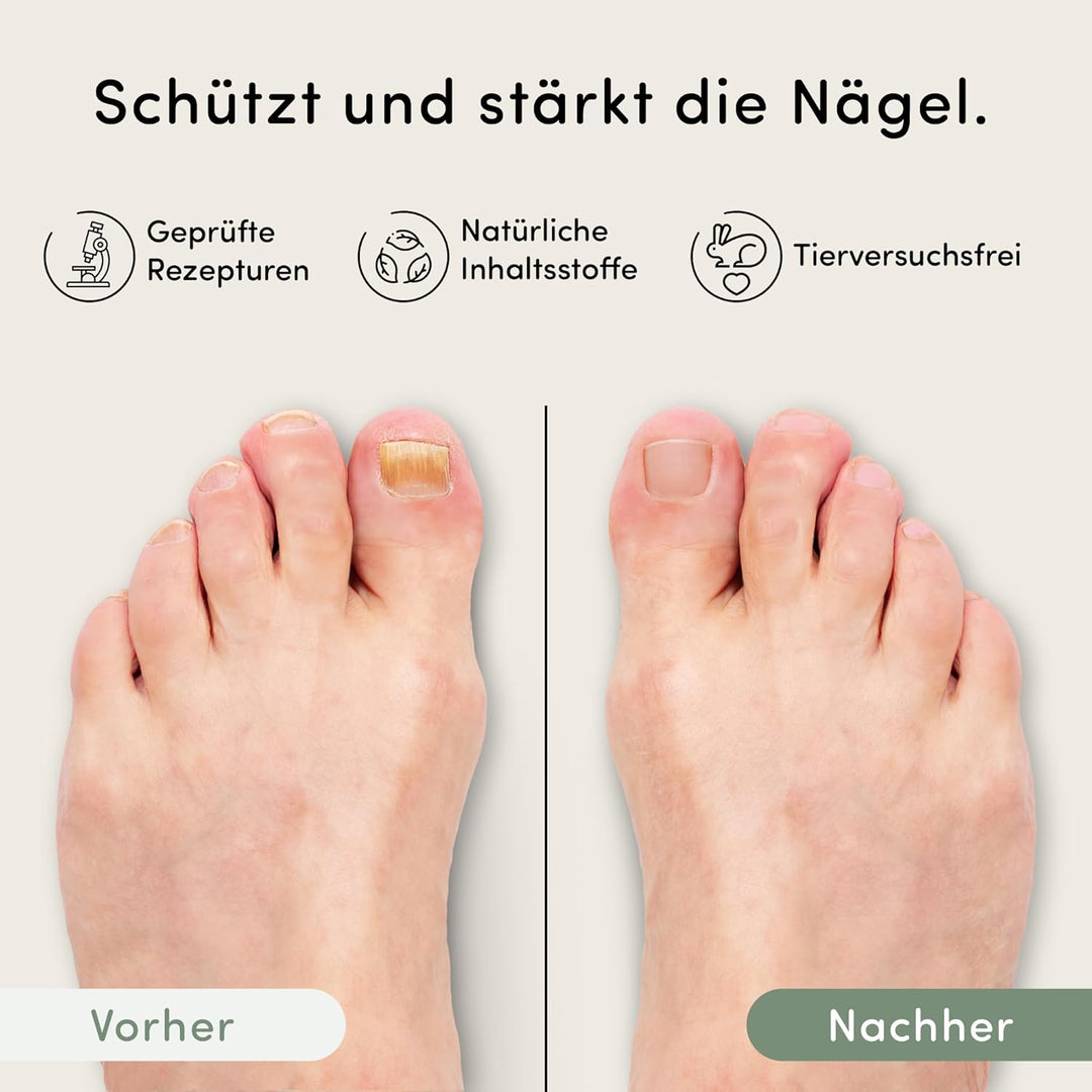 Steiger Naturals Nail Care Pen – Nagelpflegestift für Nägel mit Neem Öl, Jojoba und Teebaum - 100% N