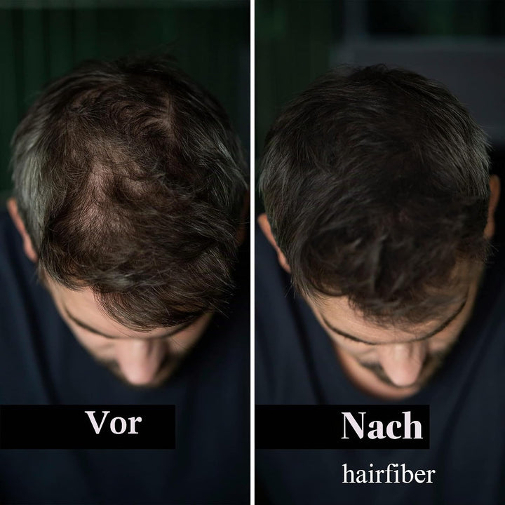 LEON MIGUEL Hair Fiber - Haarverdichtung - Premium Streuhaar/Schütthaar mit Soforteffekt bei Geheimr