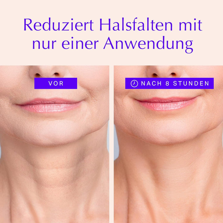 Hals Antifalten Pads - Anti-Aging Feuchtigkeitsspendende Straffende Haut-Safe Silikon Hautpflege Sch