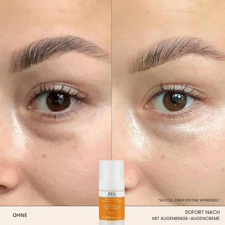 Radiance Brightening Dark Circle Eye Cream Sheabutter Dark Circle Augencreme, Dark Circle Augencreme