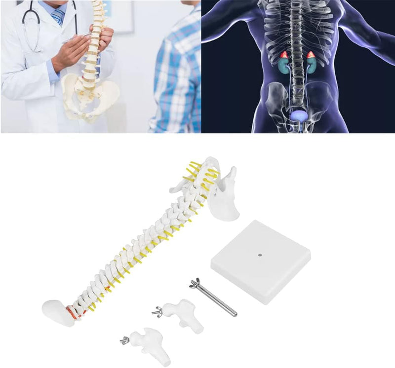 Wirbelsäule Modell, Wissenschaftliches Menschliches Wirbelsäulenmodell 45 cm Lebensgrosses Abnehmbar
