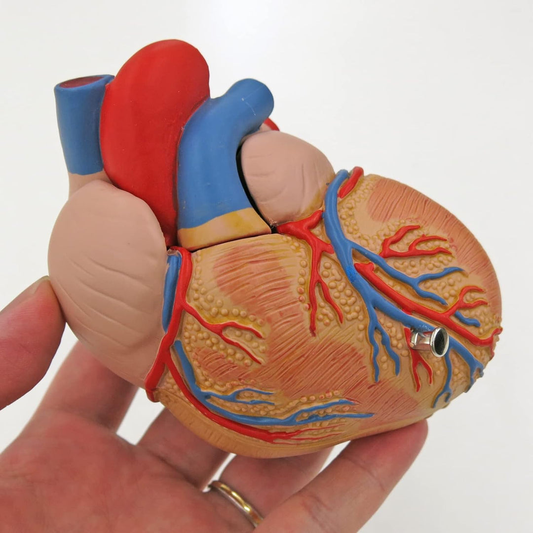 3B Scientific Menschliche Anatomie - Klassik-Herzmodell mit linksventrikulärer Hypertrophie (LVH), 2