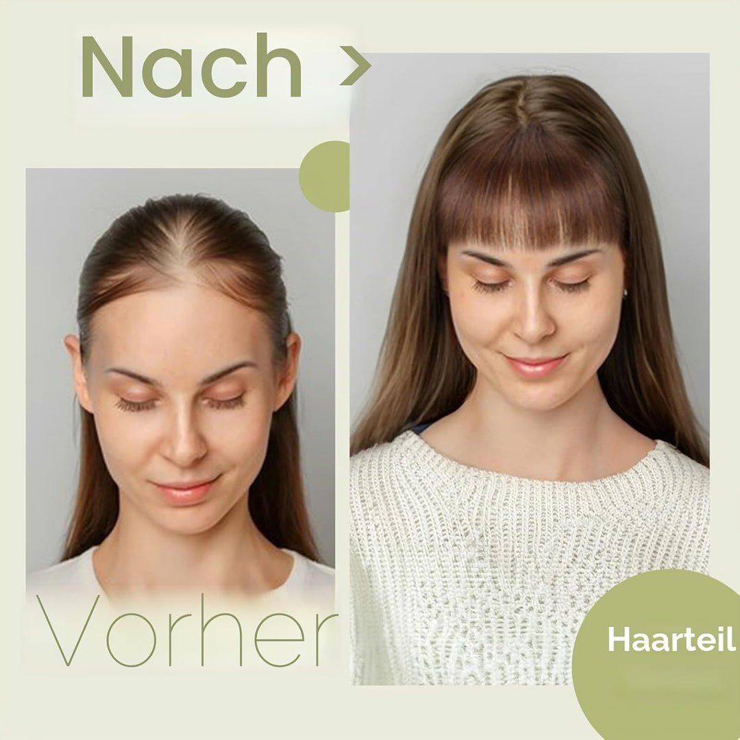 S-noilite Echthaar Hair Topper für Frauen mit Pony Haarteile für Dünnes Haar Echtes Menschliches Haa
