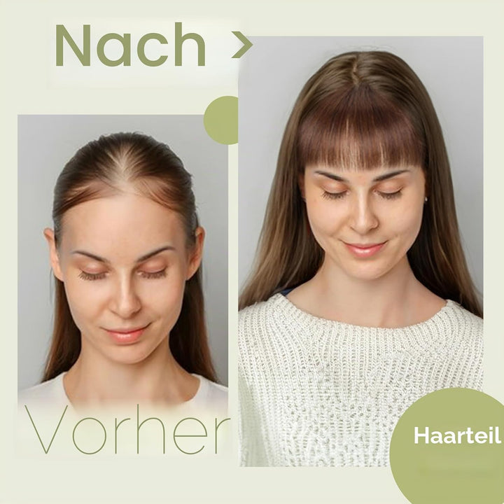 S-noilite Echthaar Hair Topper für Frauen mit Pony Haarteile für Dünnes Haar Echtes Menschliches Haa