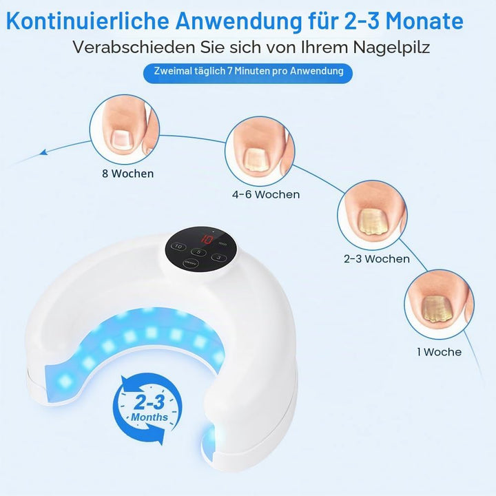 Nagelpilz Laser Gerät mit Zeitanzeige, Lichttherapiegerät für Nagelpilz, Nagelpilz-Laser, Nagelpilz