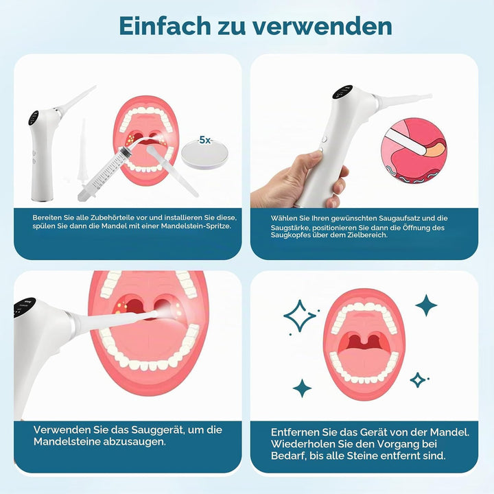 Tonsillenstein Entferner Elektrisch, Mandelsteine Entfernen Sauger mit 3 Silikonaufsätze &amp; LED, Mund