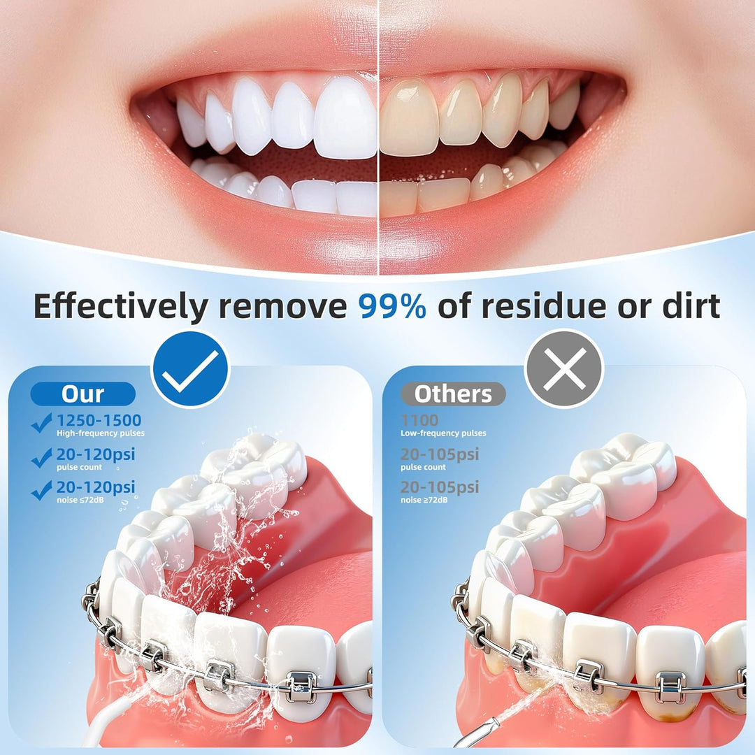 Oral Irrigator Professionell Kabellos, 300 ML Wiederaufladbare Wasserzahnreiniger mit 4 Düsen und 4