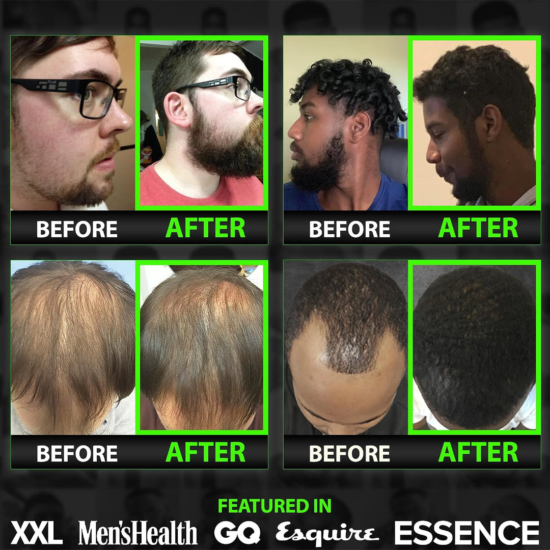 GROW Maximum XXL Beard Growth &amp; Mustache Accelerator Serum - Beard Growth Oil for Men to Fix Patchy