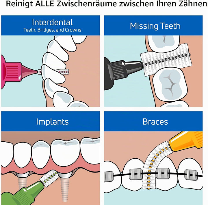 TePe Interdentalbürsten Original LILA 1,1 mm, 25 Stück Lila 25 stück (1er Pack), Lila 25 stück (1er