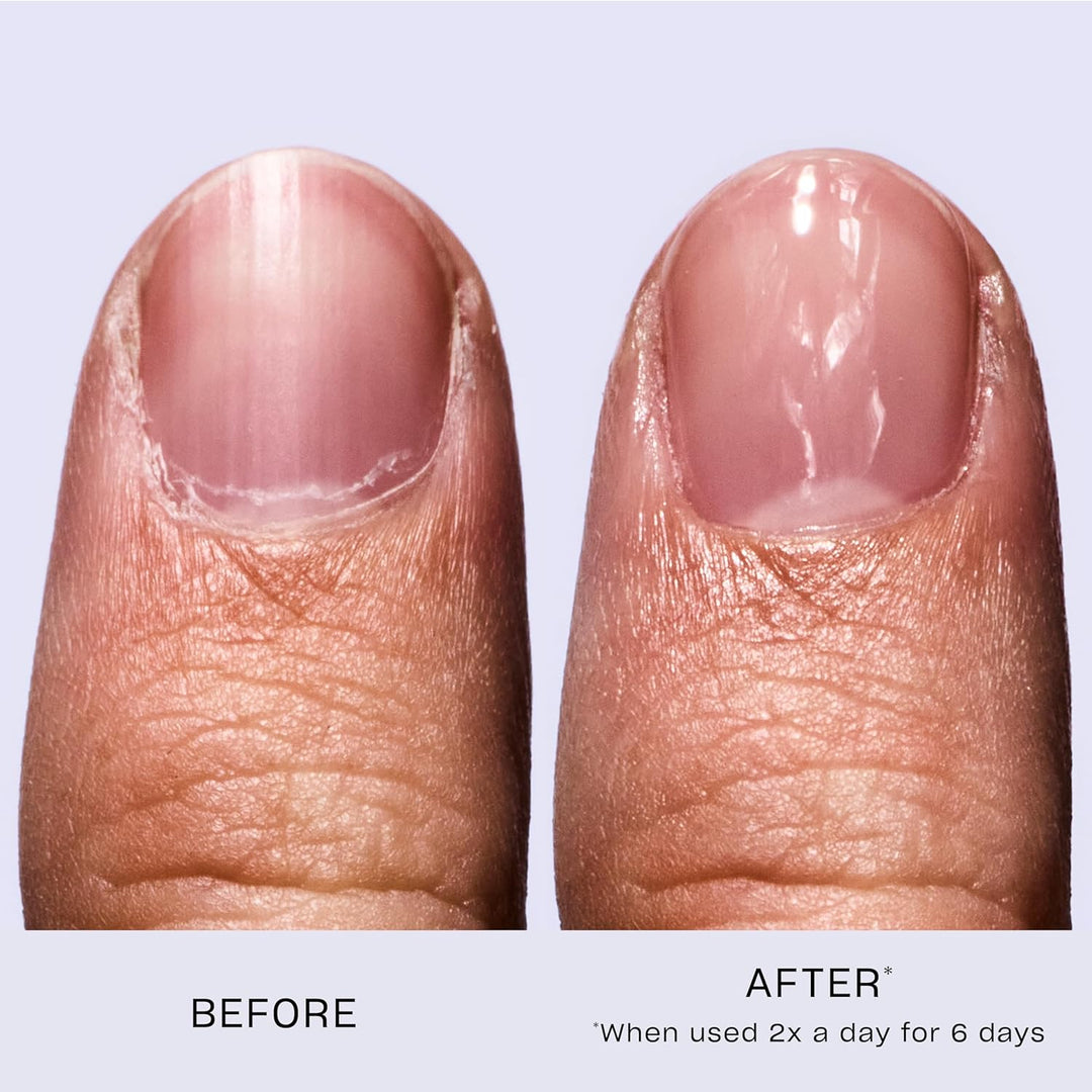 OPI Nail Envy Original – Original OPI Treatment mit veganer Formel – Schützt die Naturnägel – Für la