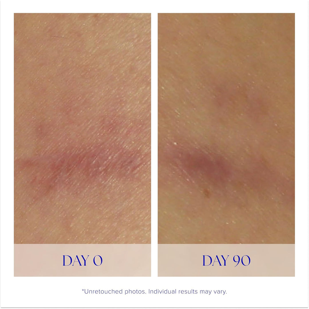 iS CLINICAL Super Serum Advance+, Anti-Aging Vitamin C Face Serum, reduces scaring and fine stretch