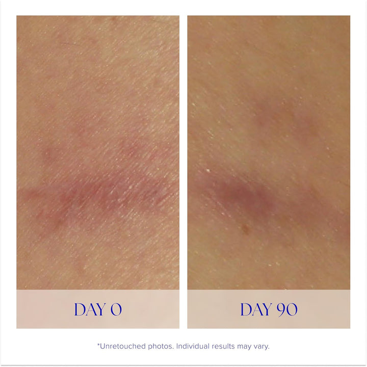 iS CLINICAL Super Serum Advance+, Anti-Aging Vitamin C Face Serum, reduces scaring and fine stretch