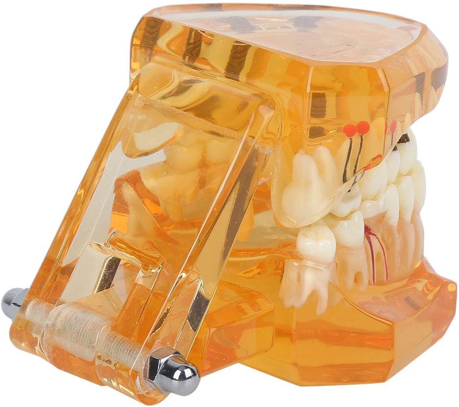 Natudeco Zahnärztliche Studienmodell untersuchen Modell Dental Maxillary Overdenture Model Minderwer