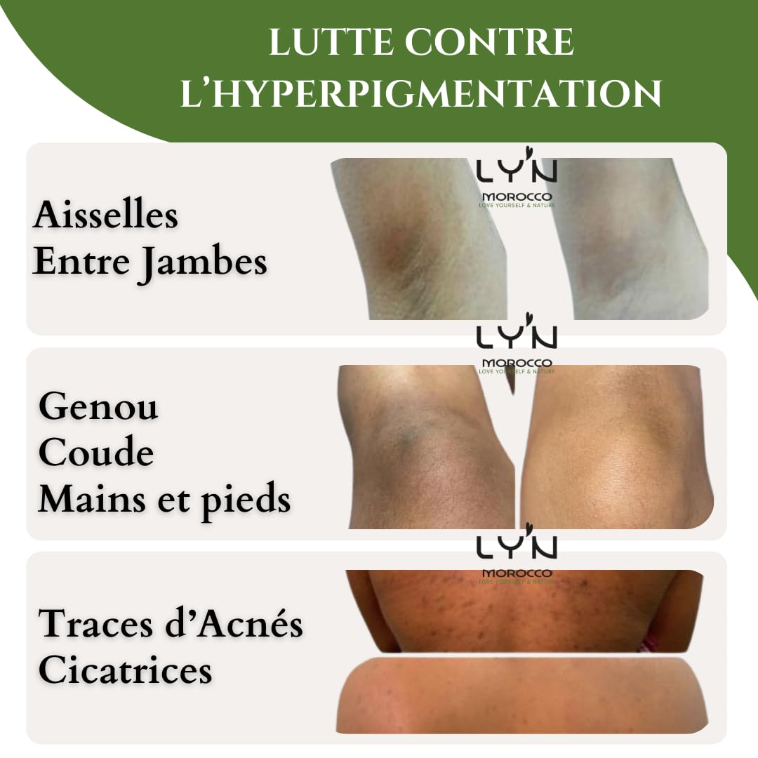Ly'n Morocco TABRIMA SAHRAOUIA NILA und Weihrauch männlich Körpermaske Exfoliant für Knie, Ellbogen,