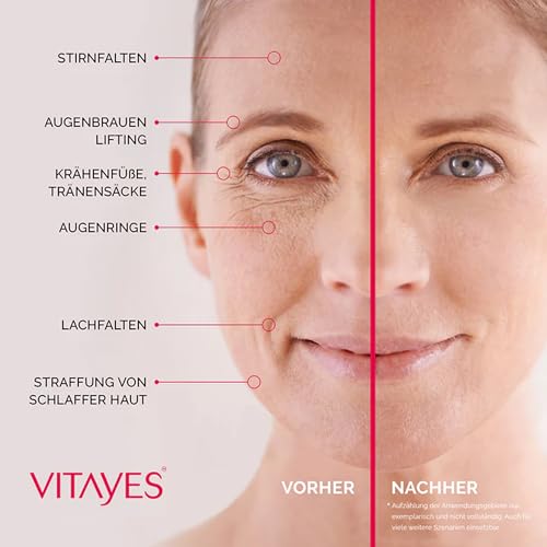 VITAYES Skincare Set Vegan - Instant Ageback 15 ml Mit Soforteffekt - Perfector Augenserum 15 ml - A
