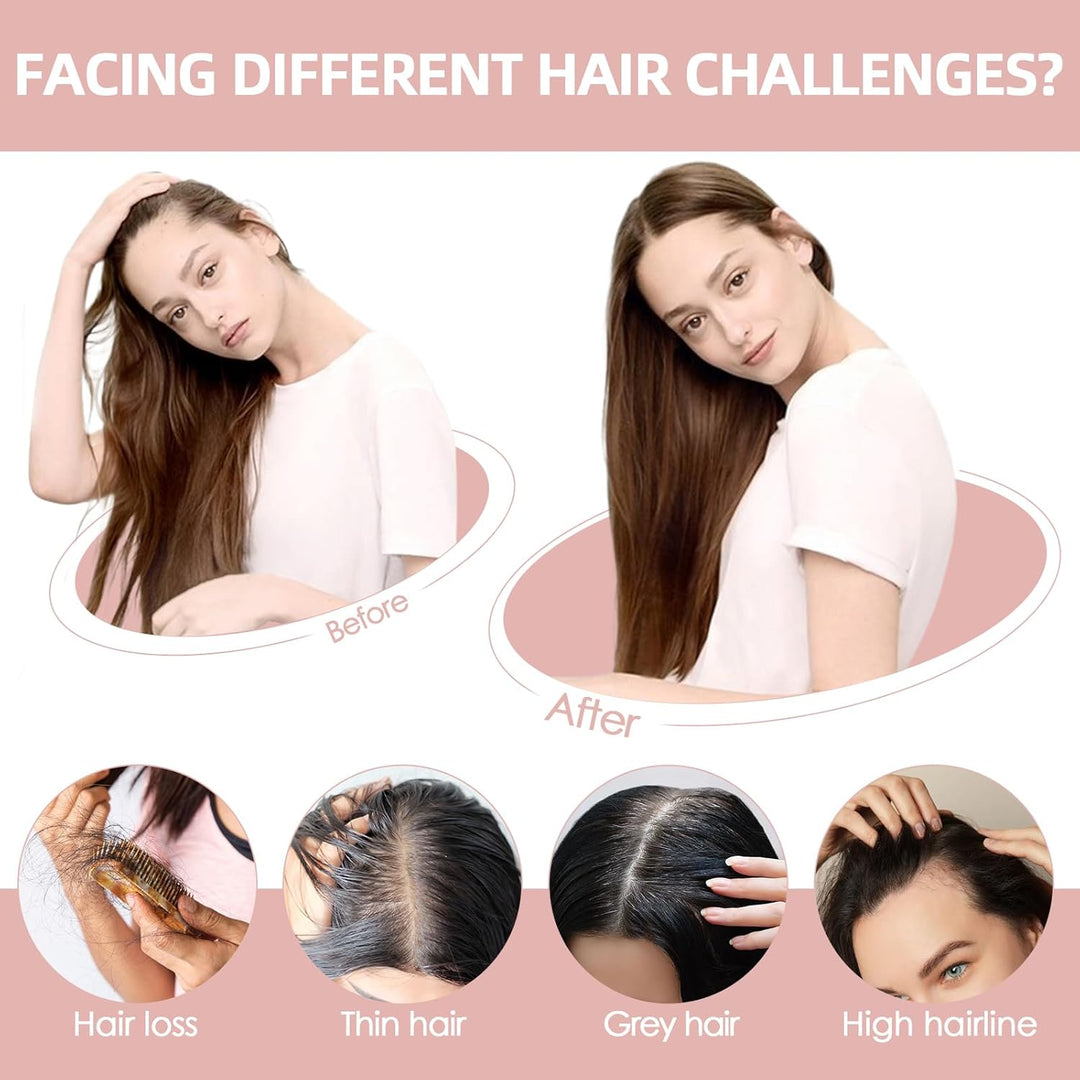 Silk-co Hair Topper Echthaar 8x10cm handgebunden Basis Toupet Damen, kein Pony Clip in Haarteile mit