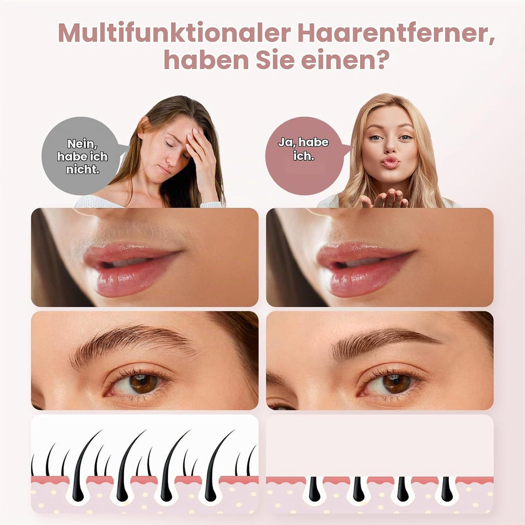 Gesichtshaarentferner für Frauen (Gen 3 Pro), guRelax Face Mini-Haarentferner, Luxus-Damenbart Entfe