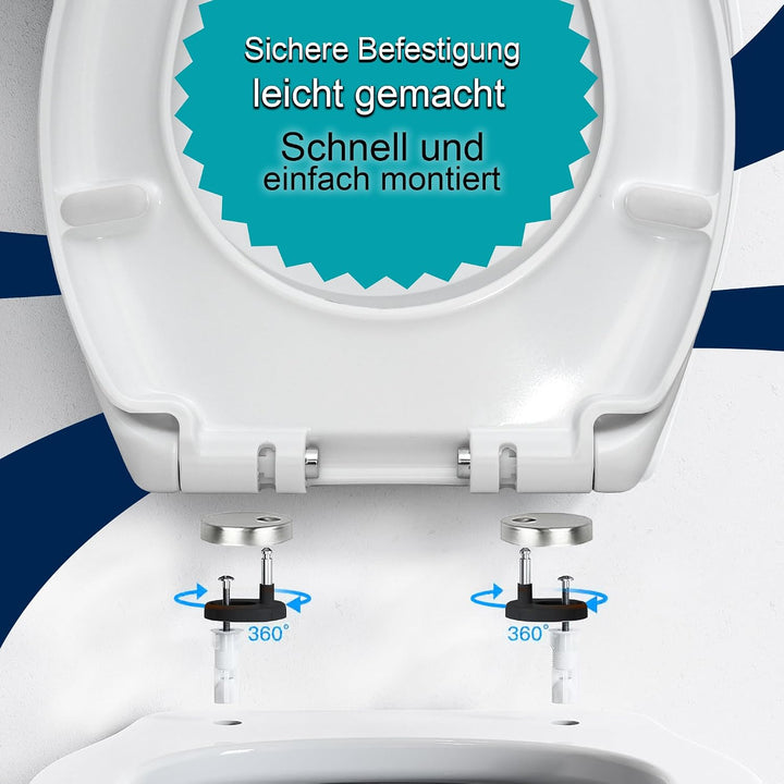 WC Sitz mit Absenkautomatik – Toilettendeckel Duroplast Soft Close – Quick Release Funktion – Univer