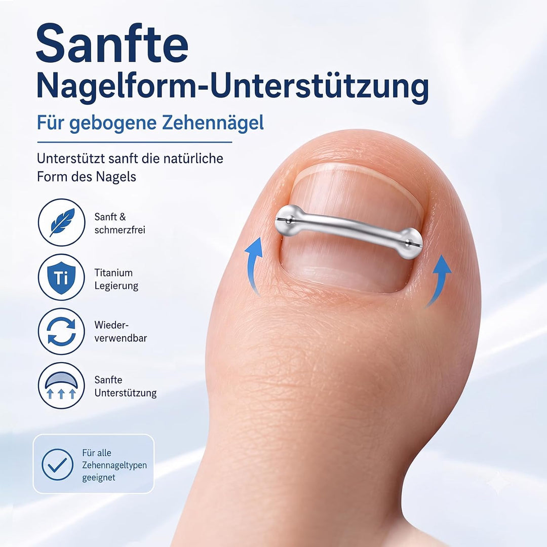Eingewachsene Zehennägel Set, Korrekturstreifen | für Eingewachsene Zehennägel, Professionelle Anwen