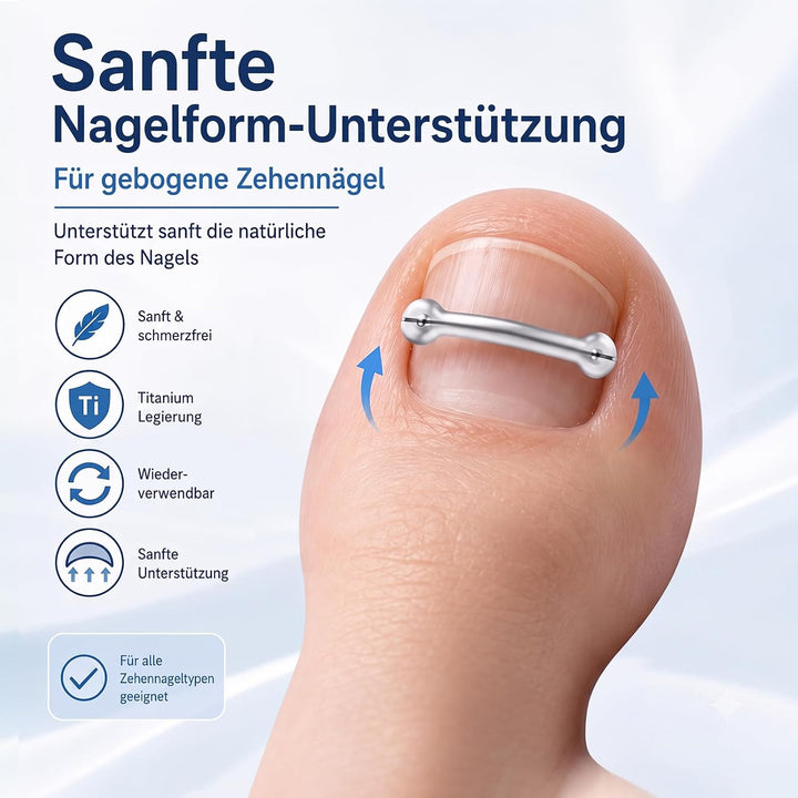 Eingewachsene Zehennägel Set, Korrekturstreifen | für Eingewachsene Zehennägel, Professionelle Anwen
