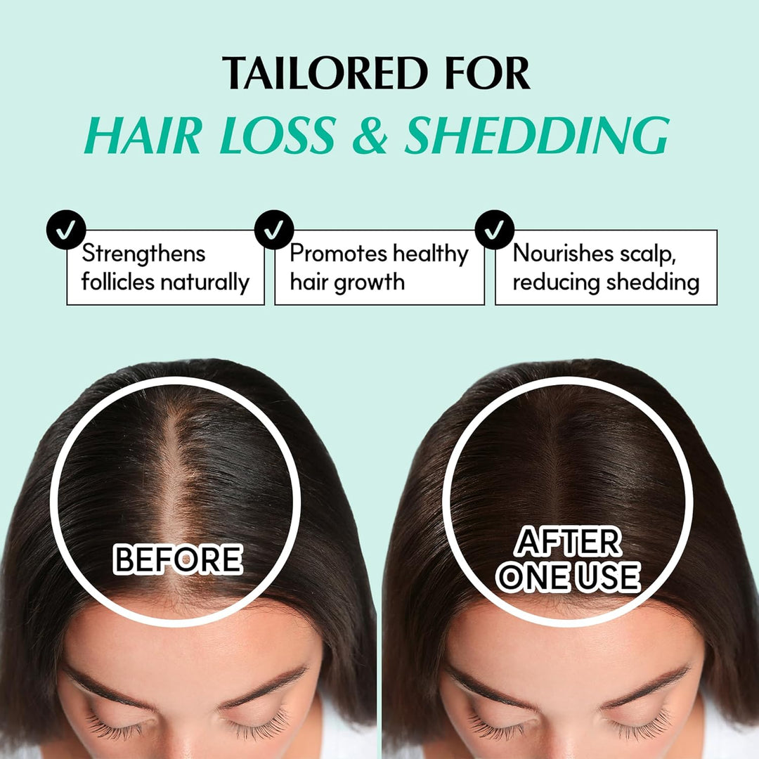 RATED GREEN REAL GROW Anti-Haarausfall-stimulierendes Kopfhautspray für Haarwachstum, koreanische Ha