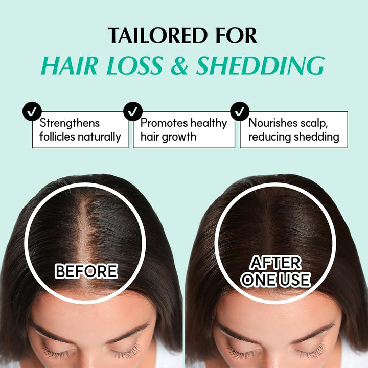 RATED GREEN REAL GROW Anti-Haarausfall-stimulierendes Kopfhautspray für Haarwachstum, koreanische Ha