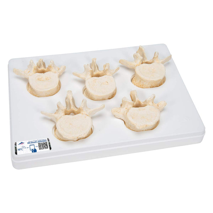 3B Scientific Menschliche Anatomie - Set mit 5 Lendenwirbeln + kostenlose Anatomie App - 3B Smart An