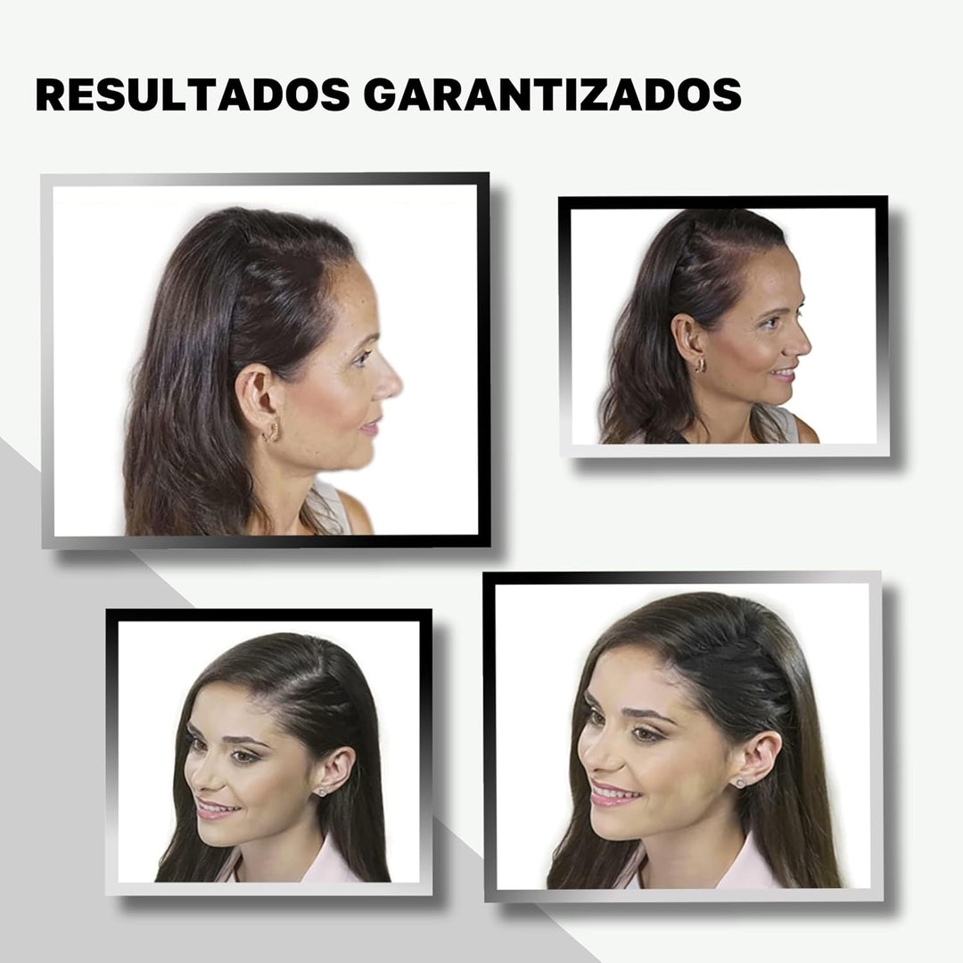 VidalForce. Streuhaar Dunkelbraun 30gr I 100% Natürlich Ansatzpuder I Dichtes Haar in 20 s I Ansatzp