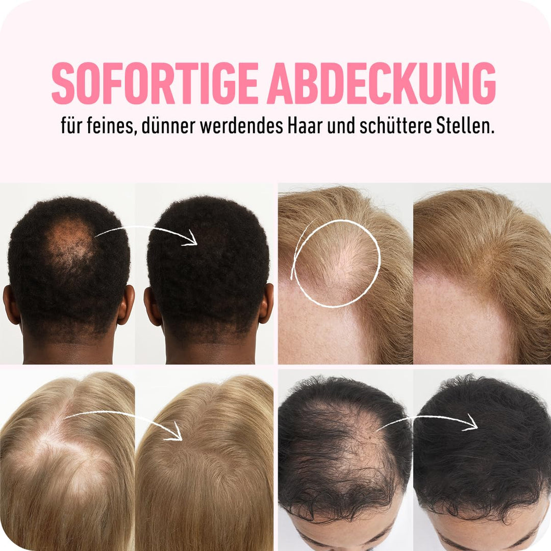 BOLDIFY Streuhaar für Dünner Werdendes Haar (Aschbraun), Unsichtbar, Natürlich, Grosse Flasche, 28g,