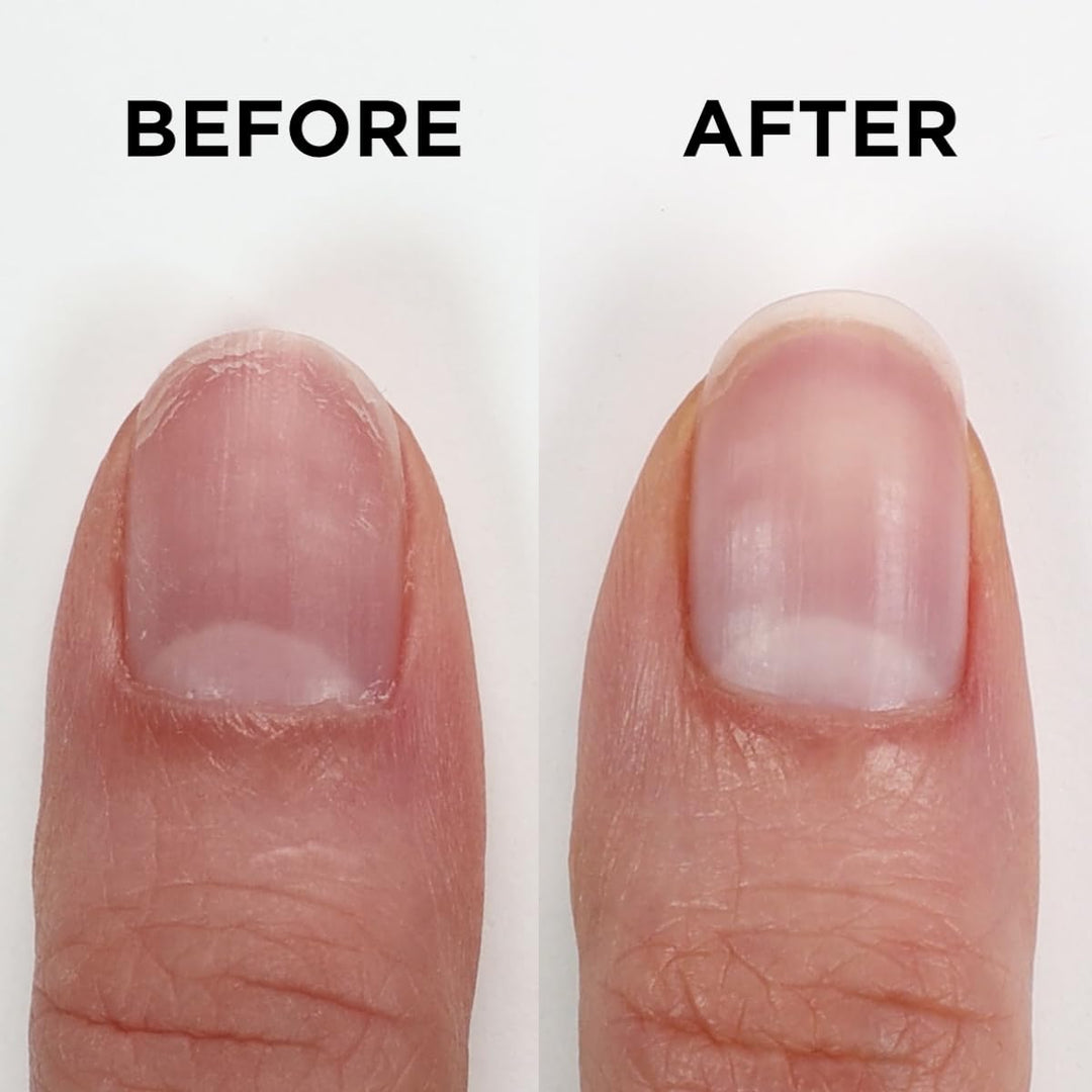 ORLY Nailtrition 18 ml | Nail Treatments | Intensivpflege | Starke & Schöne Nägel | Fördert Nagelwac