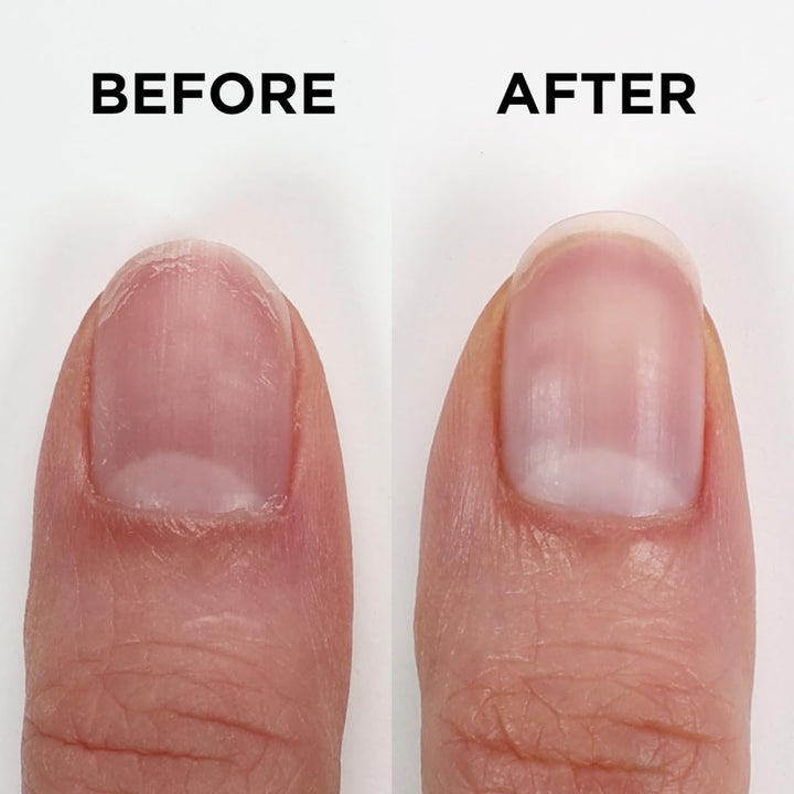 ORLY Nailtrition 18 ml | Nail Treatments | Intensivpflege | Starke & Schöne Nägel | Fördert Nagelwac
