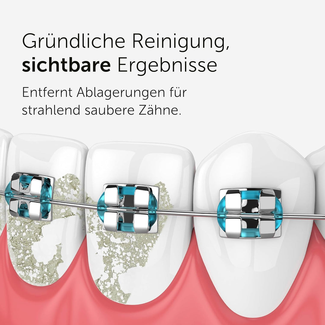 Wondersmile Periodontal Düse – Ersatzdüsen für Munddusche Waterflow - SmoothFlow-Technologie für opt