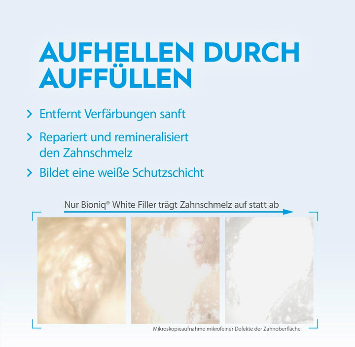 Bioniq® White Filler Zahnpasta - 4 x 75 ml – Sanfte Whitening-Zahncreme mit Hydroxylapatit, schützt