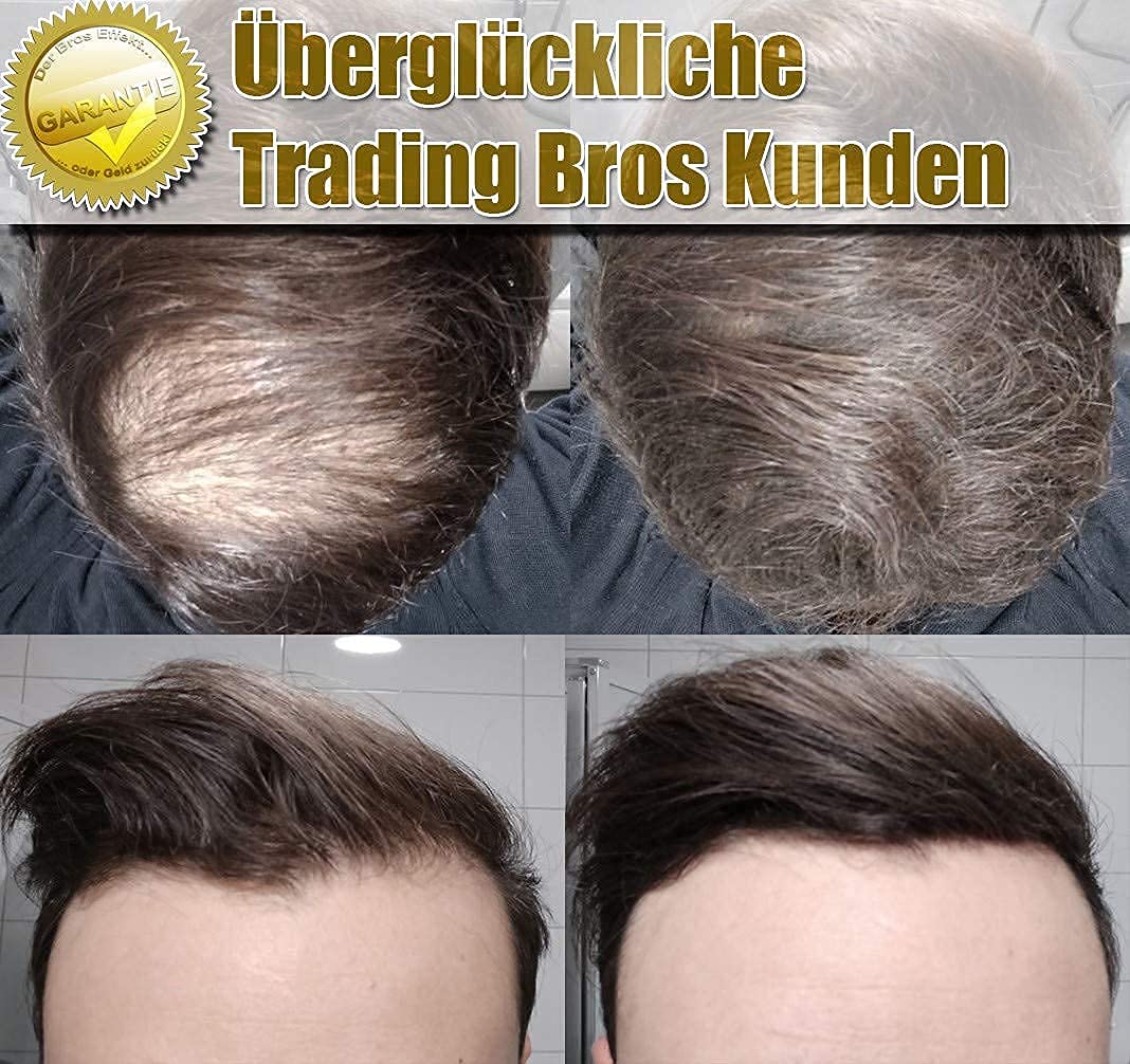 sofort dichtes Haar XXL Premium Haarverdichtung Streuhaar Schütthaar Trading Bros Dunkelbraun 28g, D