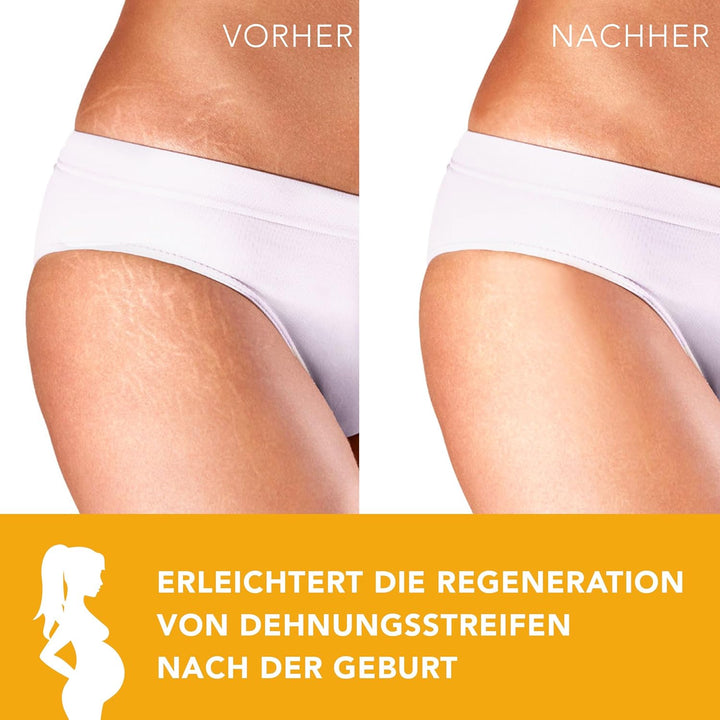 AIESI® Mandelöl Süss Ph.Eur. 100% rein kaltgepresst (1 Liter Flasche), Für pharmazeutische, lebensmi