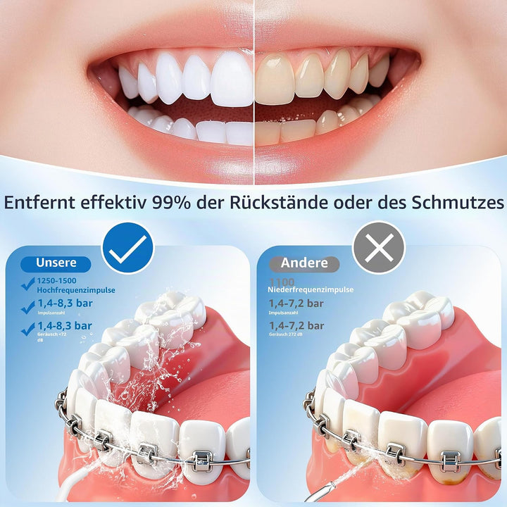 Oral Irrigator Professionell Kabellos, 300 ML Wiederaufladbare Wasserzahnreiniger mit 4 Düsen und 4