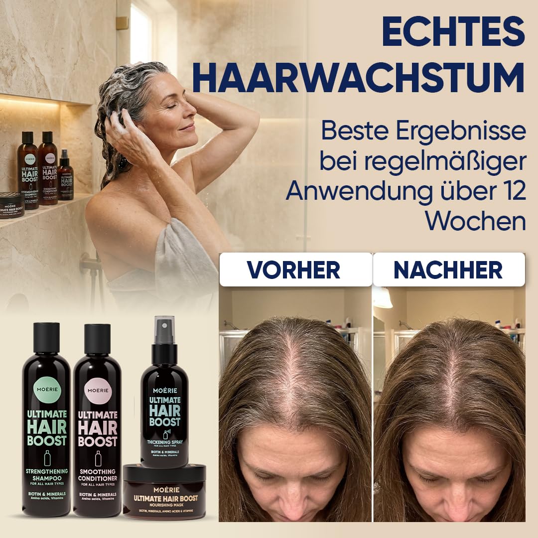 MOERIE Shampoo Set - gegen Haarausfall, Conditioner, Haarwachstum Serum & Haarmaske - natürlich Haar