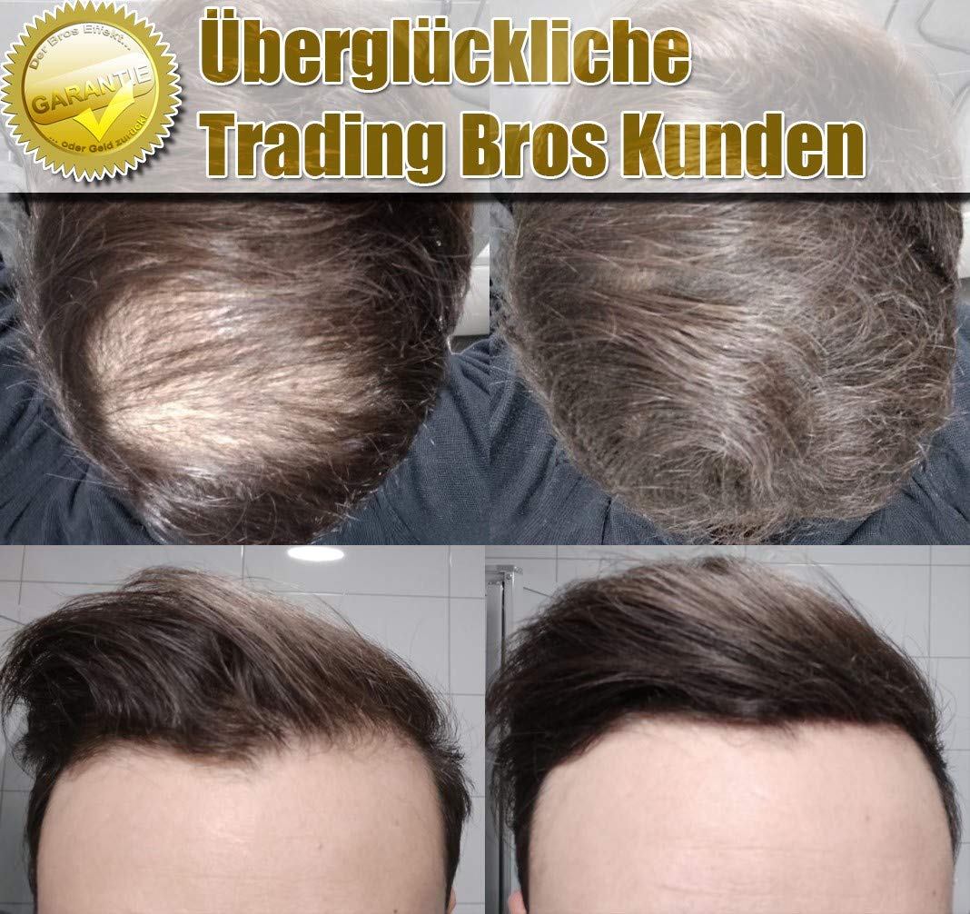 XXL Premium Streuhaar Schütthaar Haarverdichtung Trading Bros Magic Hair Fibers Schwarz 28g, Schwarz