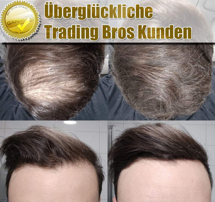 XXL Premium Streuhaar Schütthaar Haarverdichtung Trading Bros Magic Hair Fibers Schwarz 28g, Schwarz