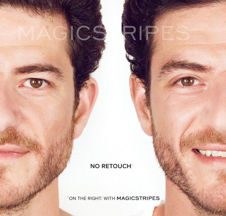 Magicstripes Augenlidkorrektur Grösse large, 64 Stück