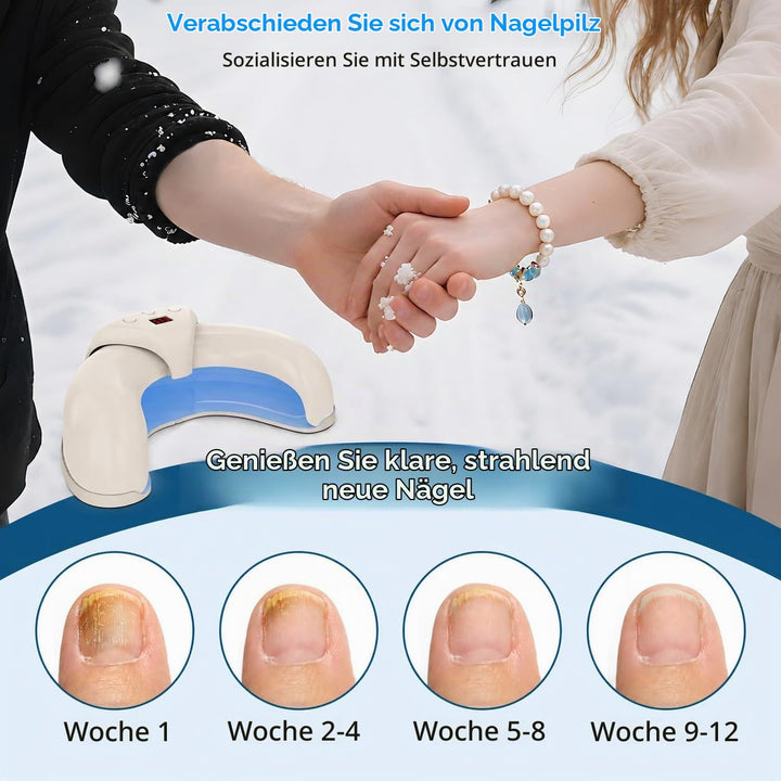 Nagelpilz Laser Gerät, Berrlly Nagelpilz Laser Device Verwendung für Mehrere Fingernägel und Zehennä