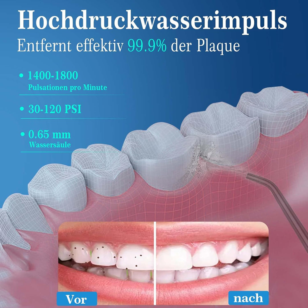 SURFOU Munddusche Kabellos Water Flosser, Elektrische Zahnseide Oral Irrigator for Teeth Zahndusche