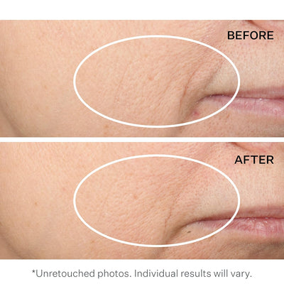 StriVectin Multi-Action Restorative Cream