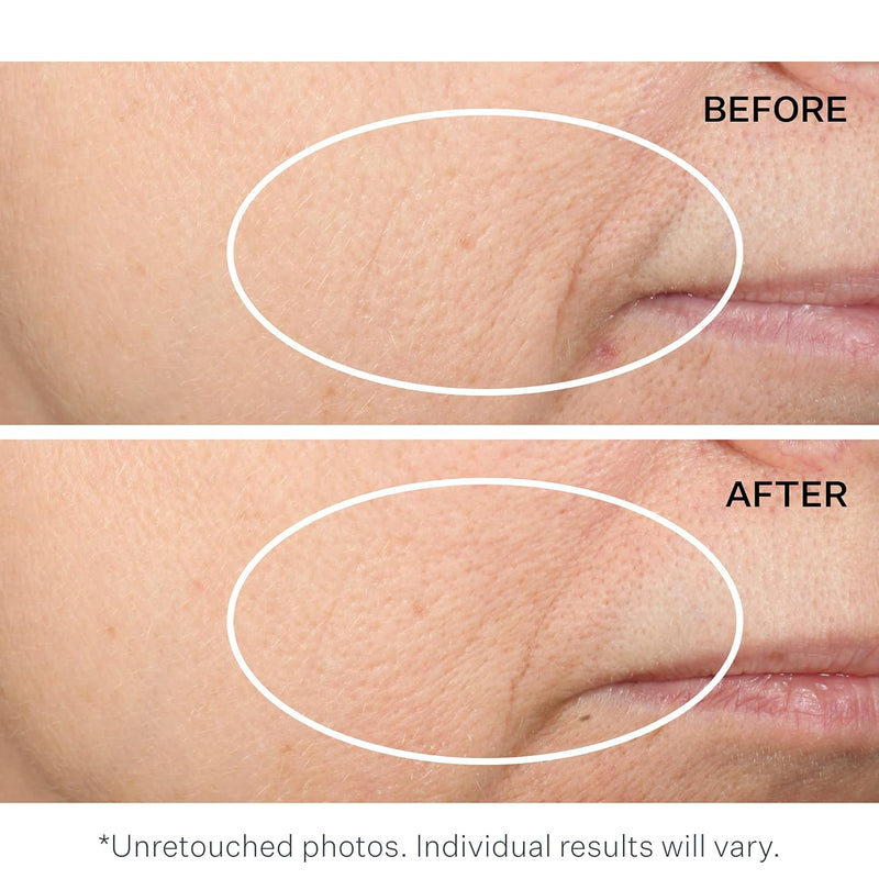 StriVectin Multi-Action Restorative Cream